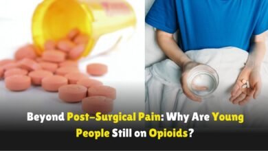 Beyond-Post-Surgical-Pain-Why-Are-Young-People-Still-on-Opioids